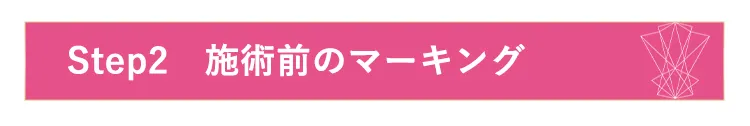 step2.施術前のマーキング