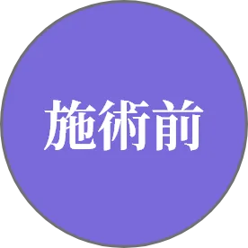 施術前