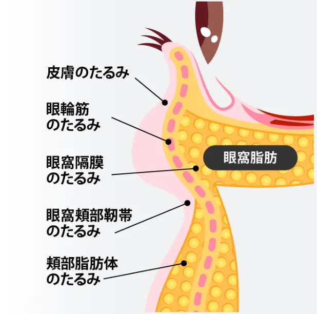 01 クマの状況を診断