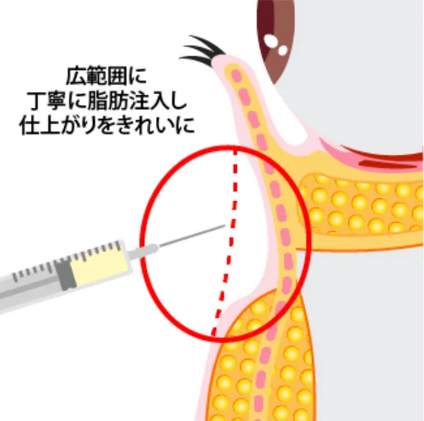 03 綺麗な状態へ