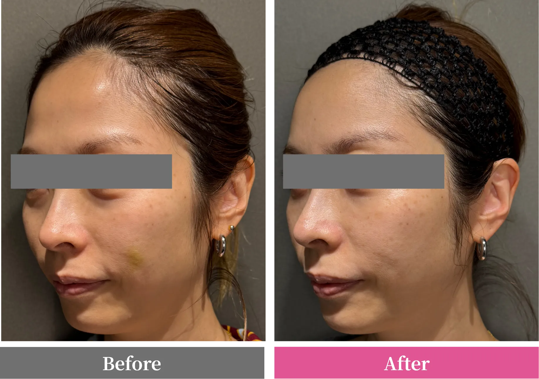 お顔の全体的な印象UP