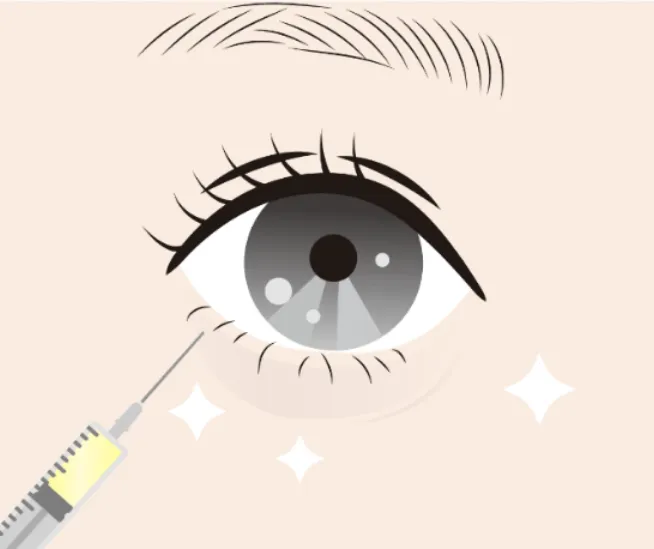 クマ以外にもある！目元に脂肪注入するメリット