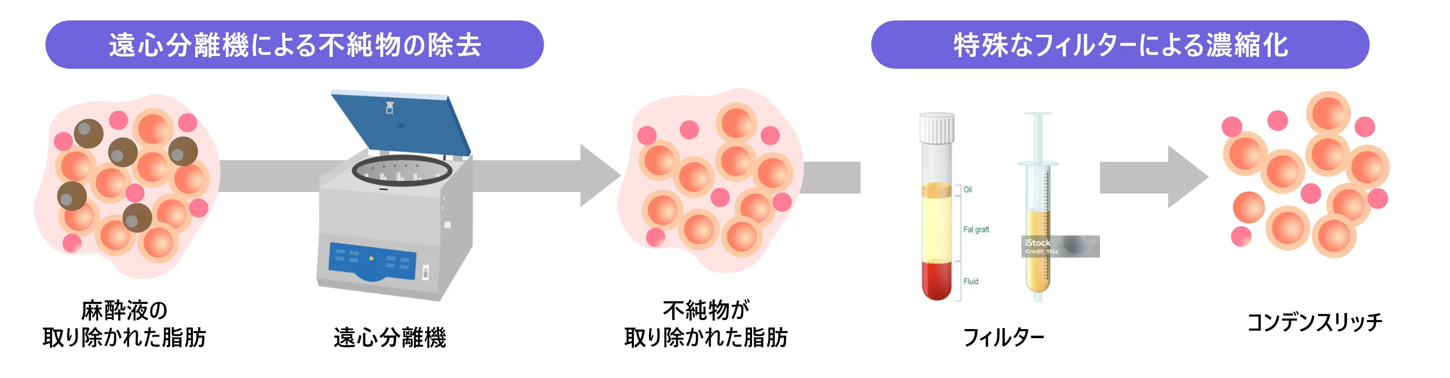 コンデンスリッチ