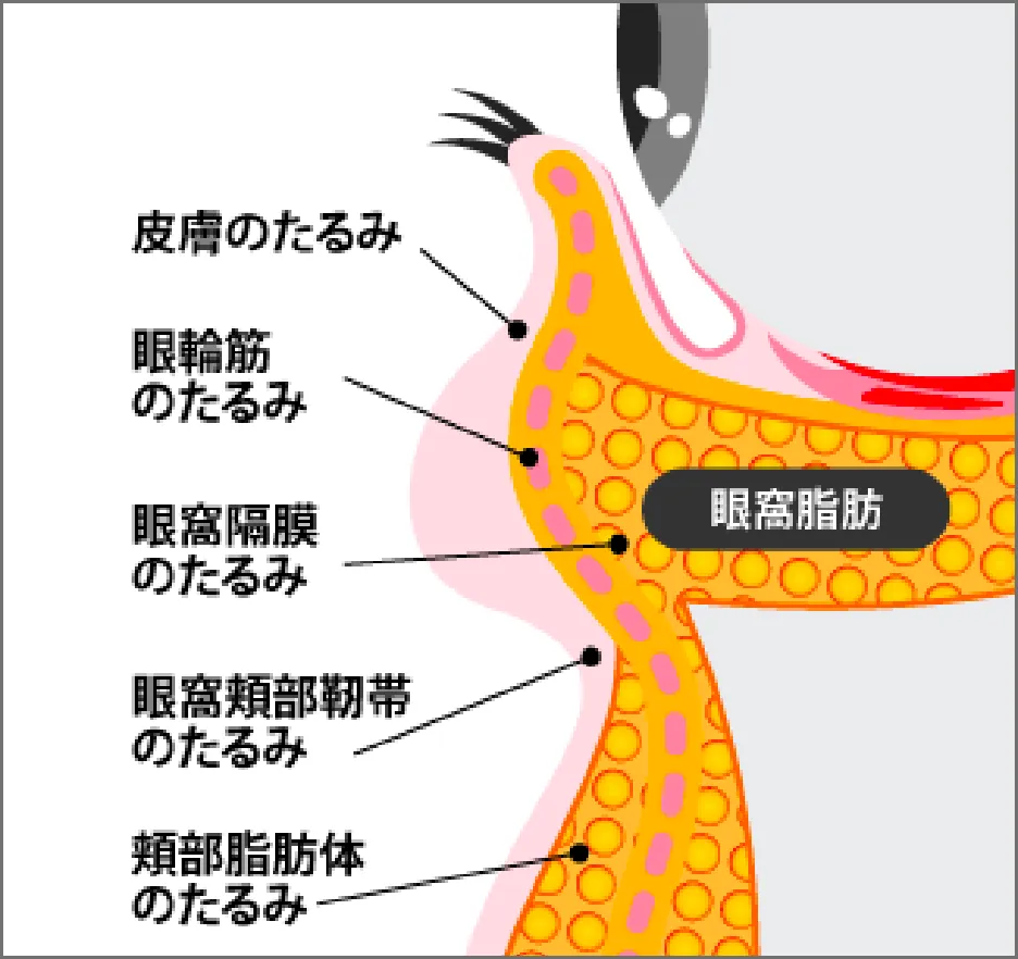 クマ取り治療の流れ：クリニックへの来院と受付の様子（ステップ01）