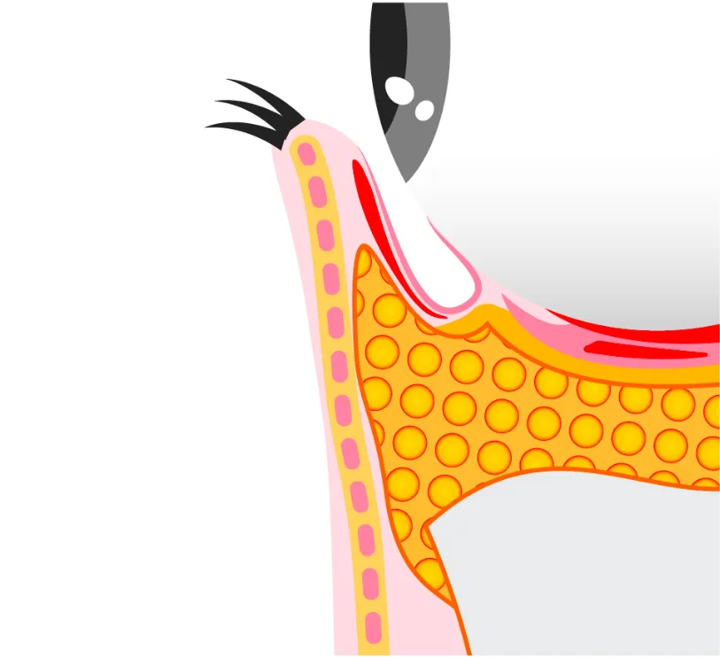 目の下の正常な構造を示したイラスト。脂肪の突出がなく、凹凸がない理想的な状態の解説。