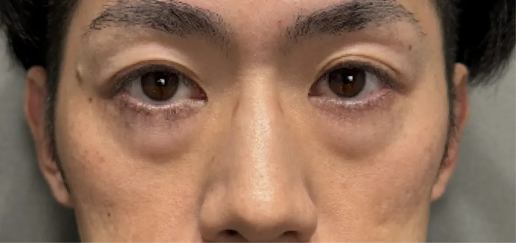 目元に暗い印象がある….